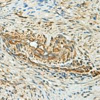 兔抗SELENOM多克隆抗体