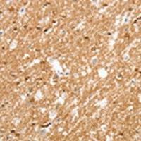 兔抗AMZ1多克隆抗体