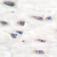 兔抗NTRK1(Phospho-Tyr791)多克隆抗体