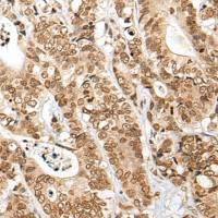 兔抗NKX3-2多克隆抗体