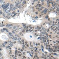 兔抗CHURC1多克隆抗体