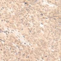 兔抗FABP4多克隆抗体