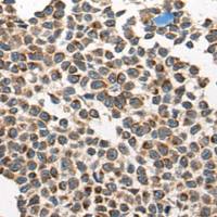 兔抗CARD16多克隆抗体