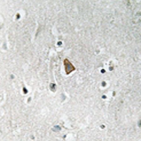 兔抗IGF1R(Phospho-Tyr1346) 多克隆抗体