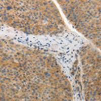 兔抗ADIPOR2多克隆抗体