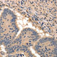 兔抗BAIAP2多克隆抗体