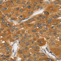 兔抗SRGAP1多克隆抗体