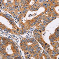 兔抗ADH1A多克隆抗体