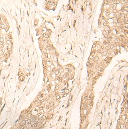 兔抗FAH多克隆抗体