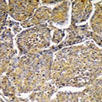 兔抗CYP8B1多克隆抗体