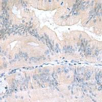 兔抗UBE2F多克隆抗体