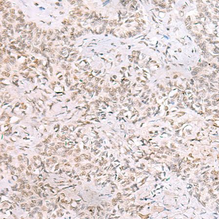 兔抗SMNDC1多克隆抗体