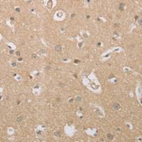 兔抗P2RY11多克隆抗体