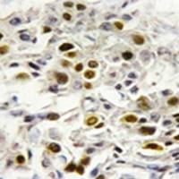 兔抗MAP3K6多克隆抗体