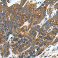 兔抗B3GNT3多克隆抗体