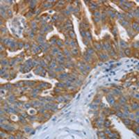 兔抗RETN多克隆抗体