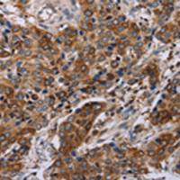 兔抗FAF1多克隆抗体