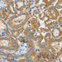 兔抗ASCC1多克隆抗体