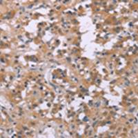 兔抗FGFR2多克隆抗体