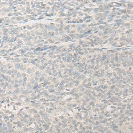 兔抗RSPH14多克隆抗体