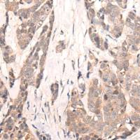 兔抗SIGLECL1多克隆抗体