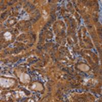 兔抗MAGEB10多克隆抗体