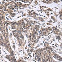 兔抗MBL2多克隆抗体