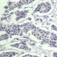 兔抗AKT1/AKT2/AKT3 (phospho-Tyr315/316/312)多克隆抗体