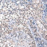 兔抗MMGT1多克隆抗体