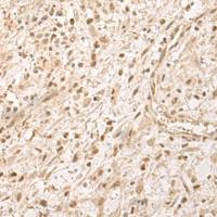 兔抗ZGPAT多克隆抗体