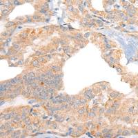 兔抗RGS19多克隆抗体