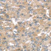 兔抗BRWD1多克隆抗体