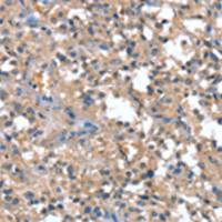 兔抗CAPZA1多克隆抗体