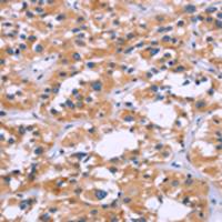 兔抗ZEB2多克隆抗体