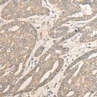 兔抗MYOZ2多克隆抗体