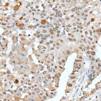 兔抗ZNF300多克隆抗体