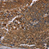 兔抗FLG多克隆抗体