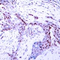 兔抗PGR (Phospho-Ser190)多克隆抗体