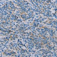 兔抗CLDN4多克隆抗体