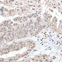 兔抗UBE2E2多克隆抗体