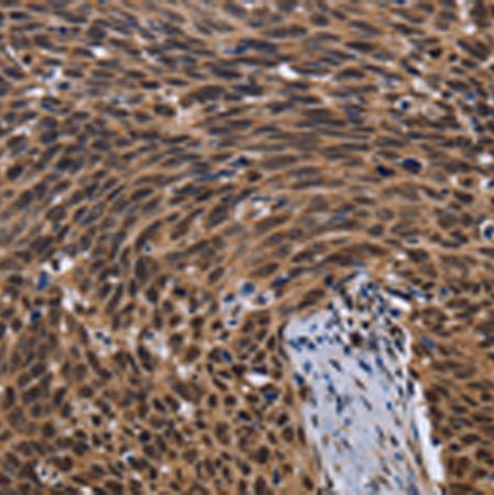 兔抗FASTKD5多克隆抗体