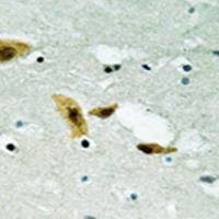 兔抗APLF(Ab-116)多克隆抗体