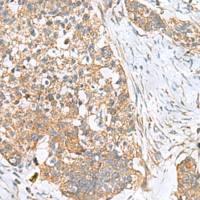 兔抗CEMIP多克隆抗体