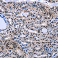 兔抗COX18多克隆抗体