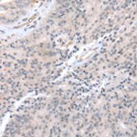 兔抗CCR10多克隆抗体