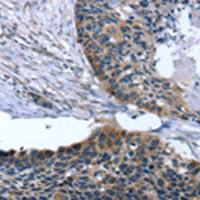 兔抗ARMC10多克隆抗体