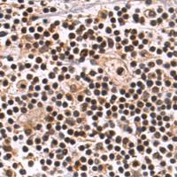 兔抗RNF114多克隆抗体