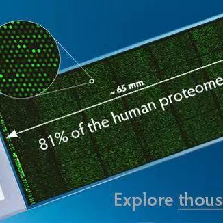 人类蛋白质组芯片（20000种蛋白，40000点）