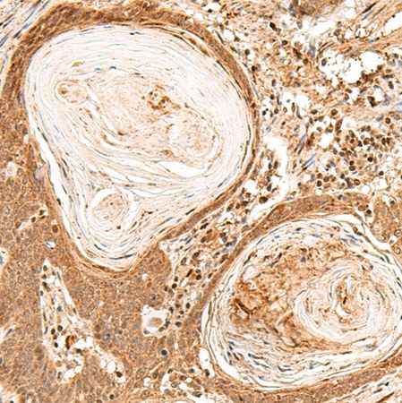 兔抗FIZ1多克隆抗体