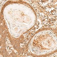 兔抗FIZ1多克隆抗体